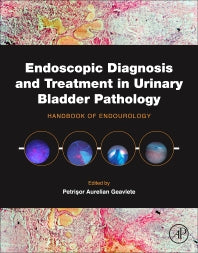 Endoscopic Diagnosis and Treatment in Urinary Bladder Pathology; Handbook of Endourology (Hardback) 9780128024393