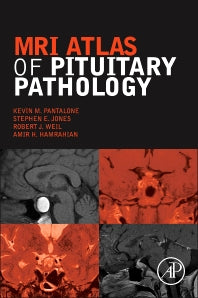 MRI Atlas of Pituitary Pathology (Hardback) 9780128025772