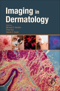 Imaging in Dermatology (Paperback) 9780128028384