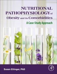 Nutritional Pathophysiology of Obesity and its Comorbidities; A Case-Study Approach (Hardback) 9780128030134