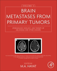 Brain Metastases from Primary Tumors, Volume 3; Epidemiology, Biology, and Therapy of Melanoma and Other Cancers (Hardback) 9780128035085