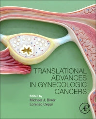 Translational Advances in Gynecologic Cancers (Paperback) 9780128037416