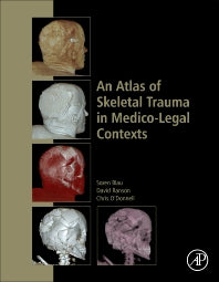 An Atlas of Skeletal Trauma in Medico-Legal Contexts (Hardback) 9780128037591