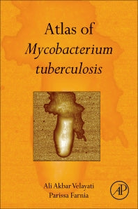 Atlas of Mycobacterium Tuberculosis (Hardback) 9780128038086