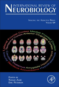 Imaging the Addicted Brain (Hardback) 9780128039144