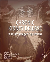 Chronic Kidney Disease in Disadvantaged Populations (Paperback / softback) 9780128043110