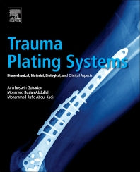 Trauma Plating Systems; Biomechanical, Material, Biological, and Clinical Aspects (Paperback) 9780128046340