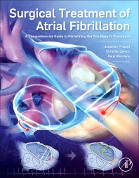 Surgical Treatment of Atrial Fibrillation; A Comprehensive Guide to Performing the Cox Maze IV Procedure (Paperback) 9780128046715