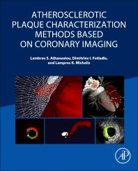 Atherosclerotic Plaque Characterization Methods Based on Coronary Imaging (Paperback) 9780128047347