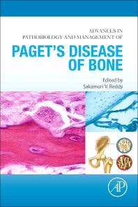 Advances in Pathobiology and Management of Paget’s Disease of Bone (Paperback / softback) 9780128050835