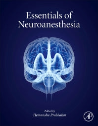 Essentials of Neuroanesthesia (Hardback) 9780128052990