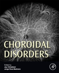 Choroidal Disorders (Hardback) 9780128053133