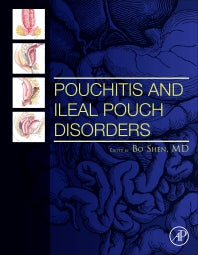 Pouchitis and Ileal Pouch Disorders; A Multidisciplinary Approach for Diagnosis and Management (Hardback) 9780128094020