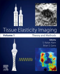 Tissue Elasticity Imaging; Volume 1: Theory and Methods (Paperback) 9780128096611