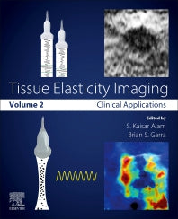 Tissue Elasticity Imaging; Volume 2: Clinical Applications (Paperback) 9780128096628