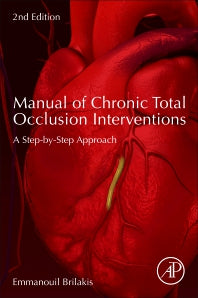 Manual of Chronic Total Occlusion Interventions; A Step-by-Step Approach (Paperback) 9780128099292