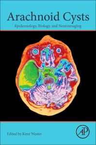 Arachnoid Cysts; Epidemiology, Biology, and Neuroimaging (Paperback / softback) 9780128099322