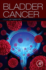 Bladder Cancer (Paperback) 9780128099391