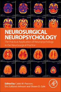 Neurosurgical Neuropsychology; The Practical Application of Neuropsychology in the Neurosurgical Practice (Paperback) 9780128099612