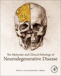 The Molecular and Clinical Pathology of Neurodegenerative Disease (Paperback) 9780128110690