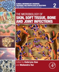 The Microbiology of Skin, Soft Tissue, Bone and Joint Infections (Paperback) 9780128110799