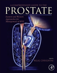 A Comprehensive Guide to the Prostate; Eastern and Western Approaches for Management of BPH (Paperback) 9780128114643