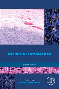 Neuroinflammation (Hardback) 9780128117095