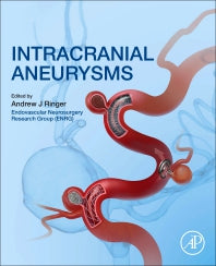 Intracranial Aneurysms (Paperback / softback) 9780128117408