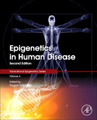 Epigenetics in Human Disease (Hardback) 9780128122150