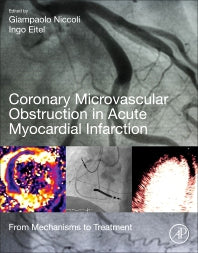 Coronary Microvascular Obstruction in Acute Myocardial Infarction; From Mechanisms to Treatment (Paperback) 9780128125281