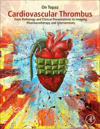 Cardiovascular Thrombus; From Pathology and Clinical Presentations to Imaging, Pharmacotherapy and Interventions (Hardback) 9780128126158