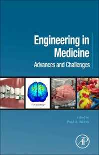 Engineering in Medicine; Advances and Challenges (Hardback) 9780128130681