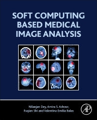 Soft Computing Based Medical Image Analysis (Paperback / softback) 9780128130872