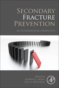 Secondary Fracture Prevention; An International Perspective (Paperback) 9780128131367