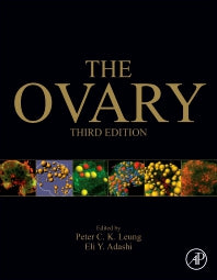 The Ovary (Hardback) 9780128132098