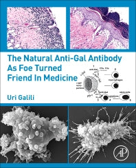 The Natural Anti-Gal Antibody as Foe Turned Friend in Medicine (Paperback) 9780128133620