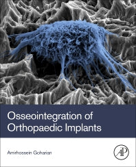 Osseointegration of Orthopaedic Implants (Paperback) 9780128133842