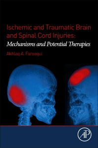 Ischemic and Traumatic Brain and Spinal Cord Injuries; Mechanisms and Potential Therapies (Paperback) 9780128135969