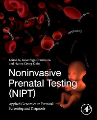 Noninvasive Prenatal Testing (NIPT); Applied Genomics in Prenatal Screening and Diagnosis (Paperback) 9780128141892