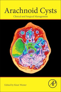 Arachnoid Cysts; Clinical and Surgical Management (Paperback / softback) 9780128143780