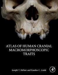 Atlas of Human Cranial Macromorphoscopic Traits (Hardback) 9780128143858