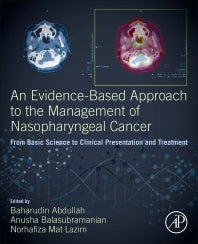 An Evidence-Based Approach to the Management of Nasopharyngeal Cancer; From Basic Science to Clinical Presentation and Treatment (Paperback) 9780128144039