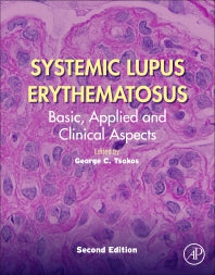 Systemic Lupus Erythematosus; Basic, Applied and Clinical Aspects (Paperback) 9780128145517