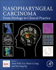 Nasopharyngeal Carcinoma; From Etiology to Clinical Practice (Paperback) 9780128149362