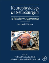 Neurophysiology in Neurosurgery; A Modern Approach (Hardback) 9780128150009