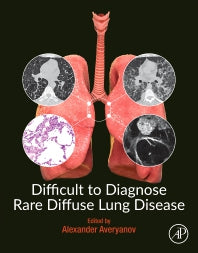 Difficult to Diagnose Rare Diffuse Lung Disease (Paperback / softback) 9780128153758