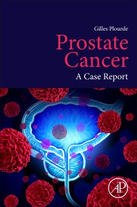 Prostate Cancer; A Case Report (Paperback) 9780128159668