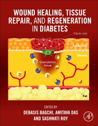 Wound Healing, Tissue Repair, and Regeneration in Diabetes (Paperback) 9780128164136