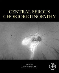 Central Serous Chorioretinopathy (Paperback) 9780128168004