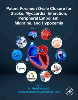 Patent Foramen Ovale Closure for Stroke, Myocardial Infarction, Peripheral Embolism, Migraine, and Hypoxemia (Paperback) 9780128169667